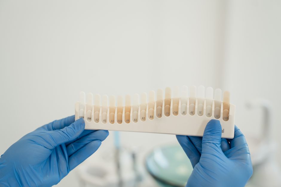 How do professional take-home whitening trays compare to in-office whitening?