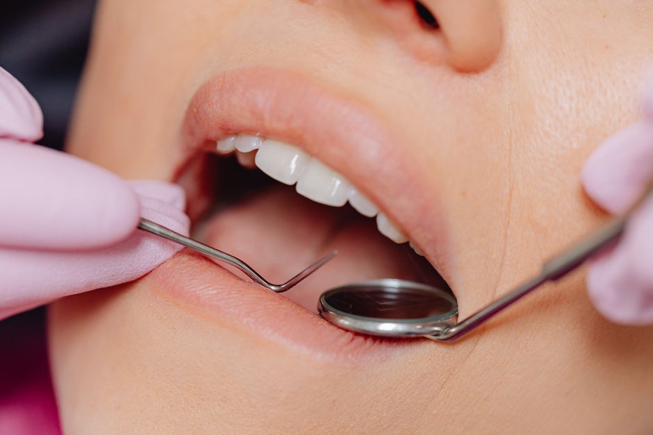 How does a dental hygienist determine if I need a scaling and root planing versus a regular cleaning?